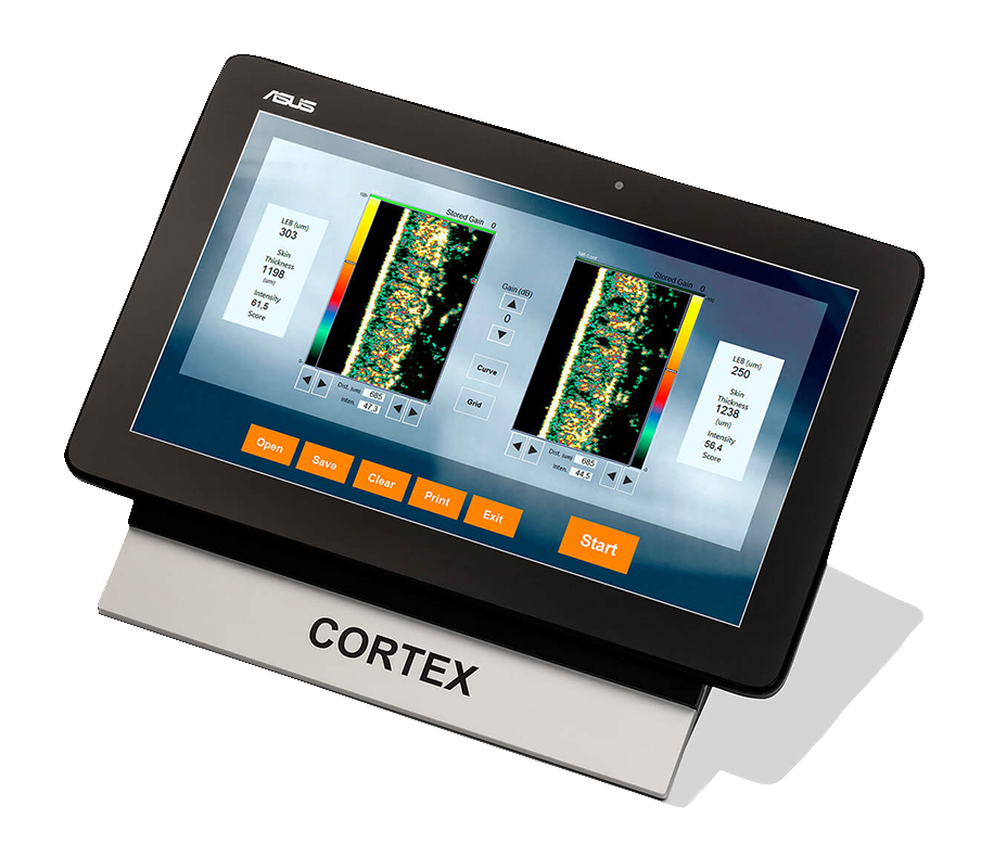 cortex ipad